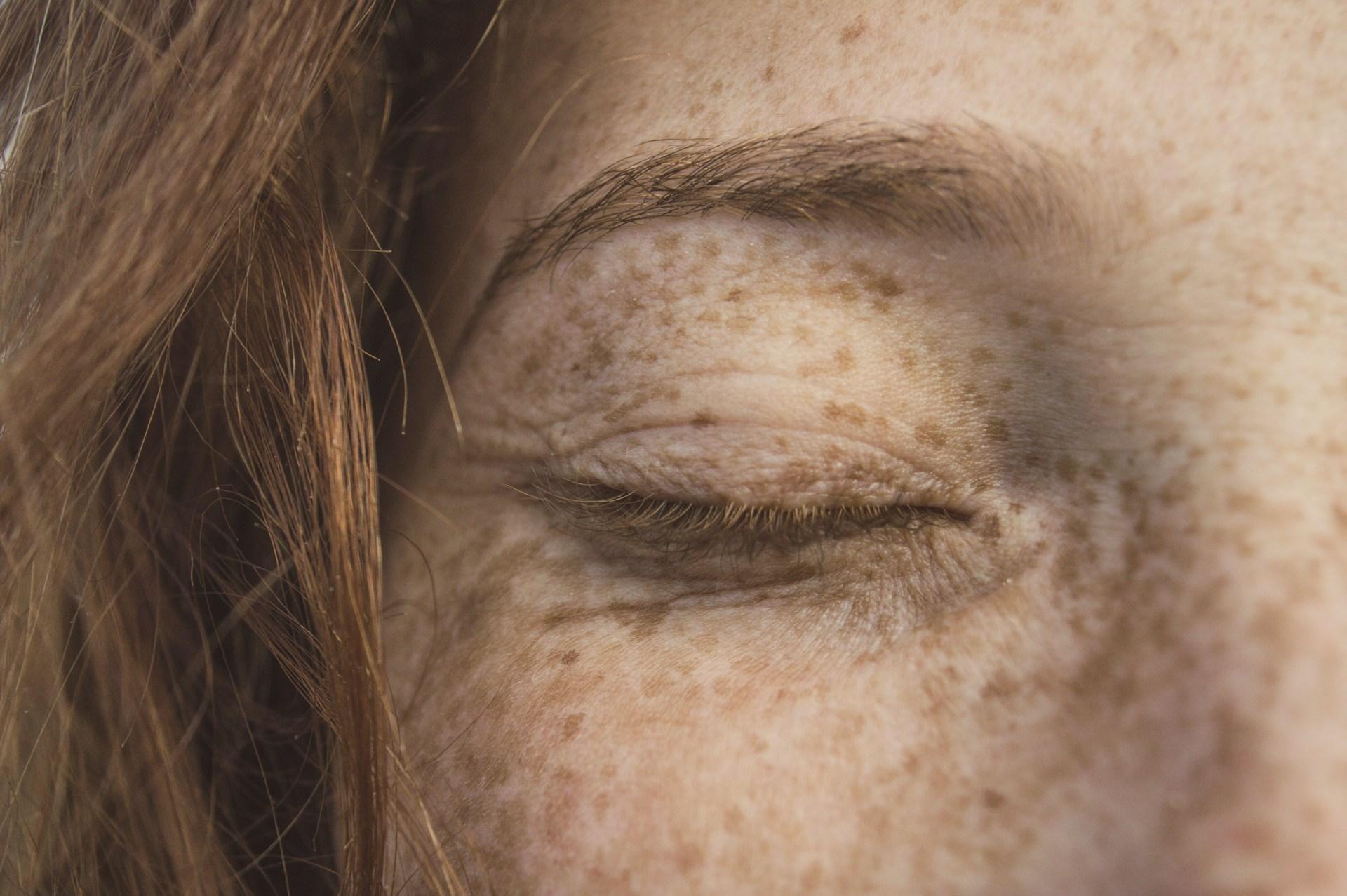 Close up of closed eye with freckles